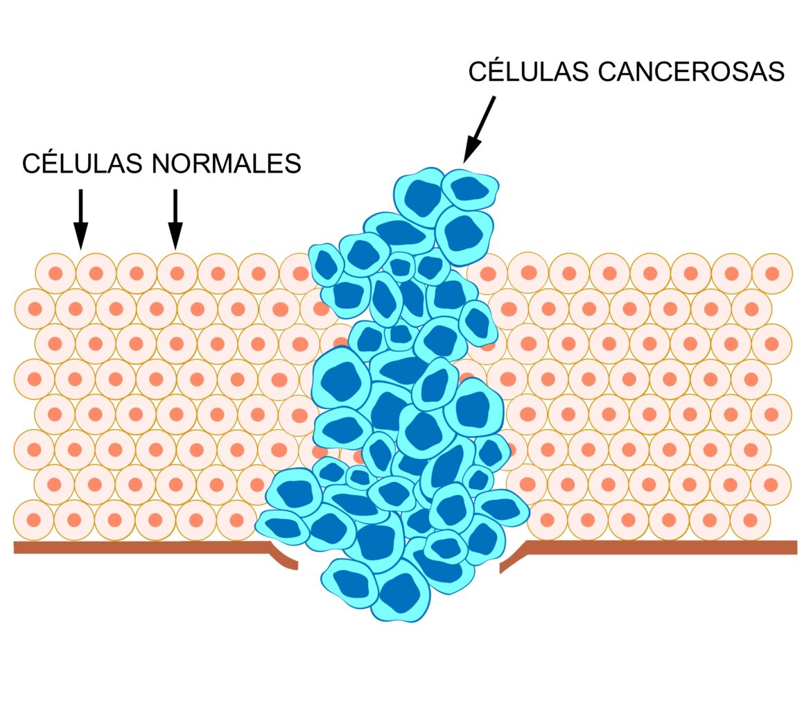 Cancer