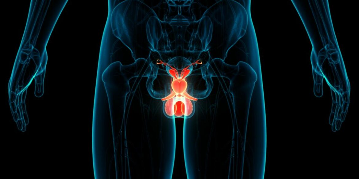 Cáncer de Próstata